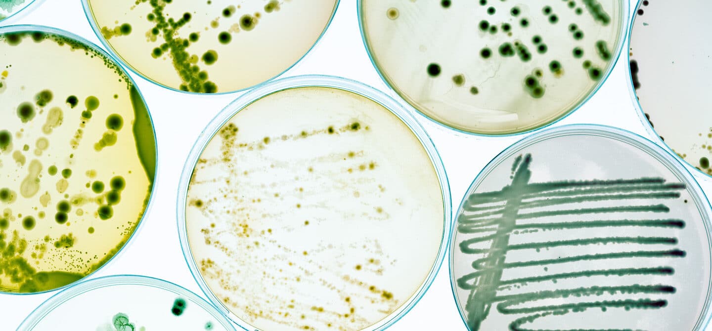 培养皿中的细菌